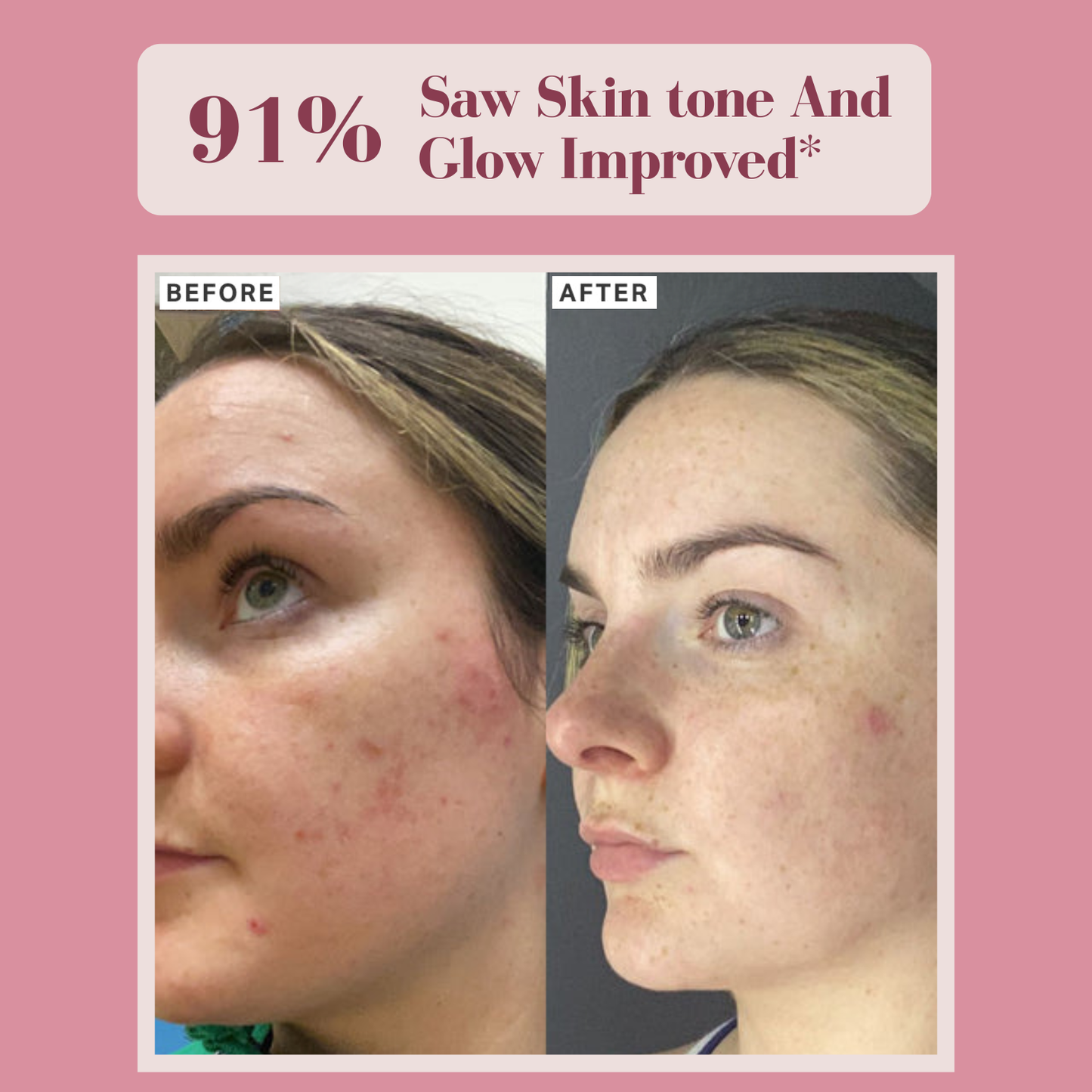 Aloa Brightening Pads