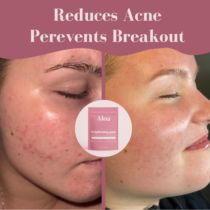 Aloa Brightening Pads
