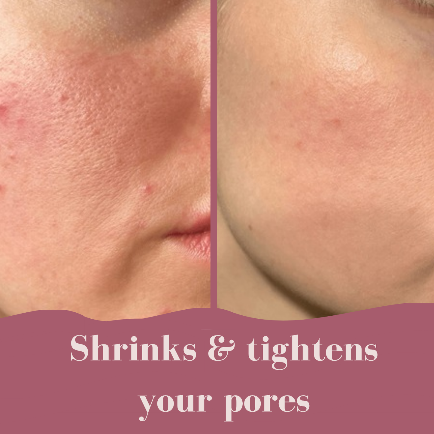 Aloa Brightening Pads