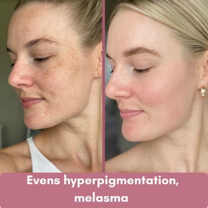 Aloa Brightening Pads