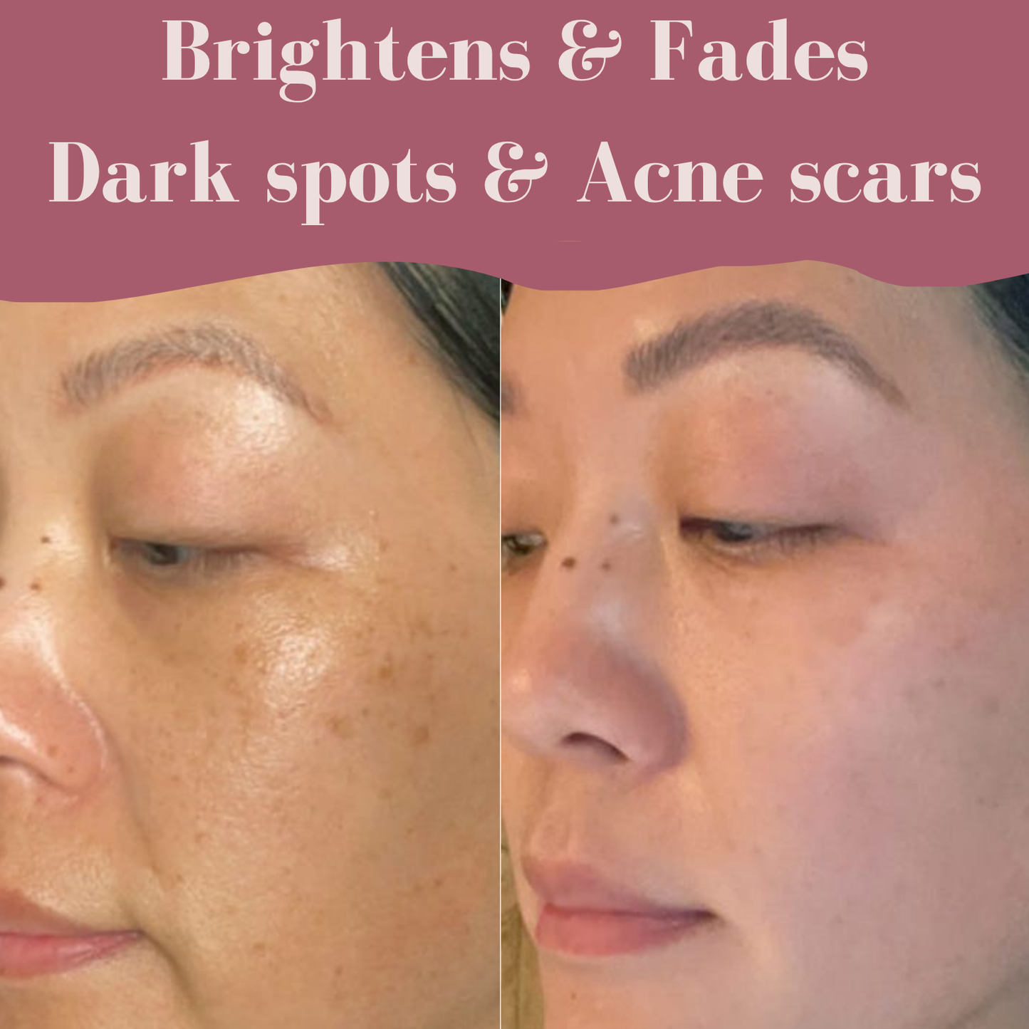 Aloa Brightening Pads