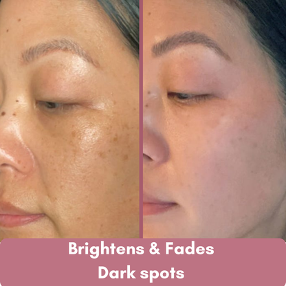 Aloa Brightening Pads