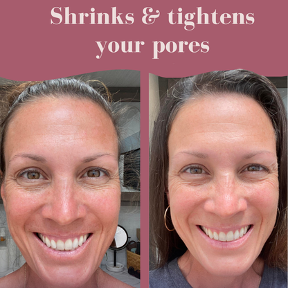 Aloa Brightening Pads