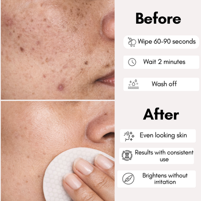 Aloa Brightening Pads